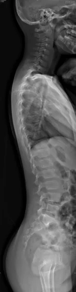 Spine Diagram