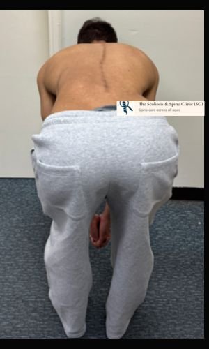 Follow-up imaging
