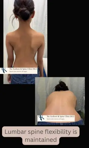 1-year postoperative clinical photo