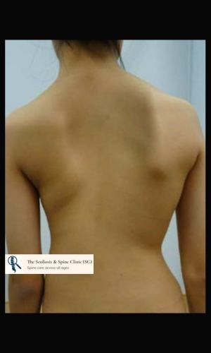 Preoperative clinical photo
