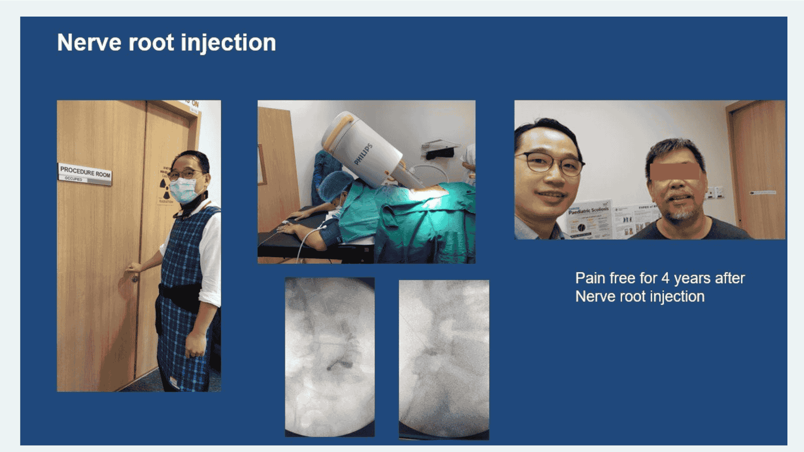 Nerve root injection performed by Dr Lau