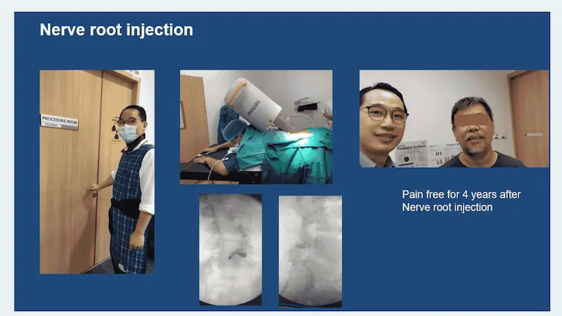 Nerve root injection performed by Dr Lau