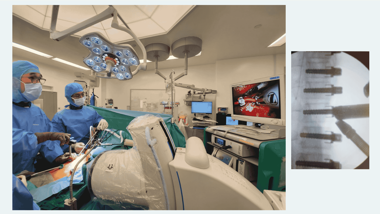Dr Lau performing vertebral body tethering (VBT) surgery